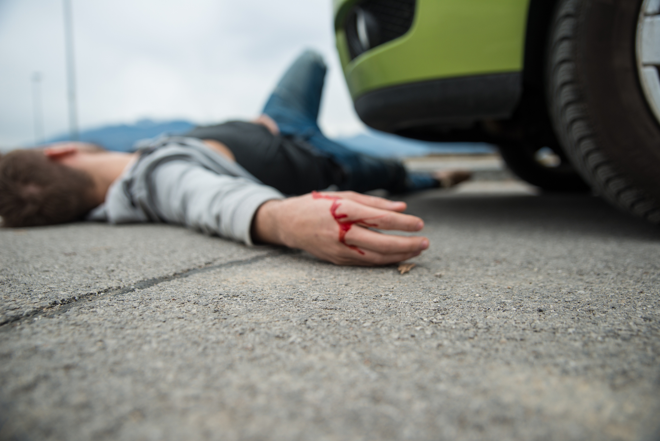 What Are Your Rights if You’re Involved in a Hit-and-Run Accident in Florida?